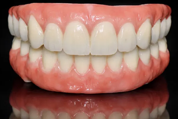 Complete upper and lower All-on-X zirconia prosthetics with detailed gingival characterization on a black reflective surface