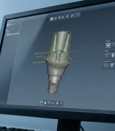 A close-up, high-resolution digital rendering of a professional dental CAD software interface. The screen displays a detailed 3D model of a custom implant abutment, featuring a visible emergence profile, margin line, and internal screw channel geometry with green mesh overlays and technical reference guides on a dark UI.