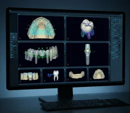 A professional, dark-themed digital dental CAD interface displayed on a high-resolution monitor in a cool-toned studio. The screen shows a grid layout of multiple simultaneous dental design cases including a full-arch mesh, a single crown, an implant-supported bridge, and a precision abutment. Detailed wireframe overlays, alignment guides, and technical tool panels are visible, emphasizing high-volume digital laboratory workflow and professional design scale.n