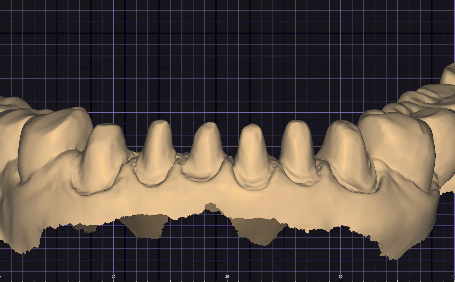 3D scan model of lower dental arch on precision measurement grid